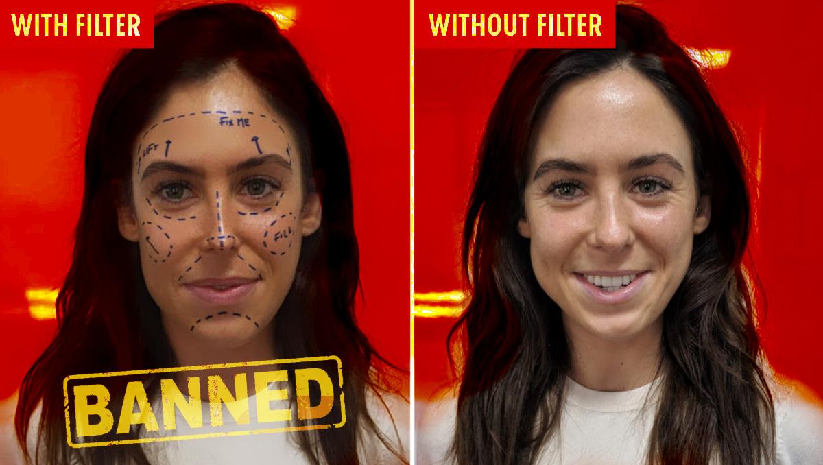 instagram plastic surgery filter banned
